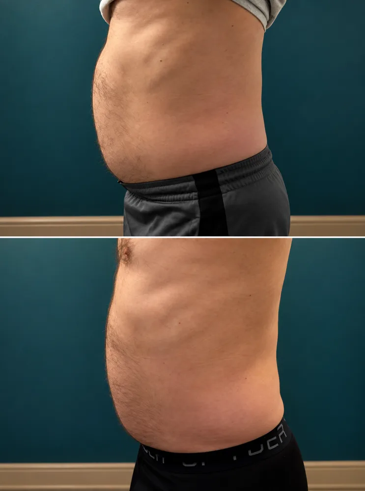 Body Dynamics client before-and-after result 9