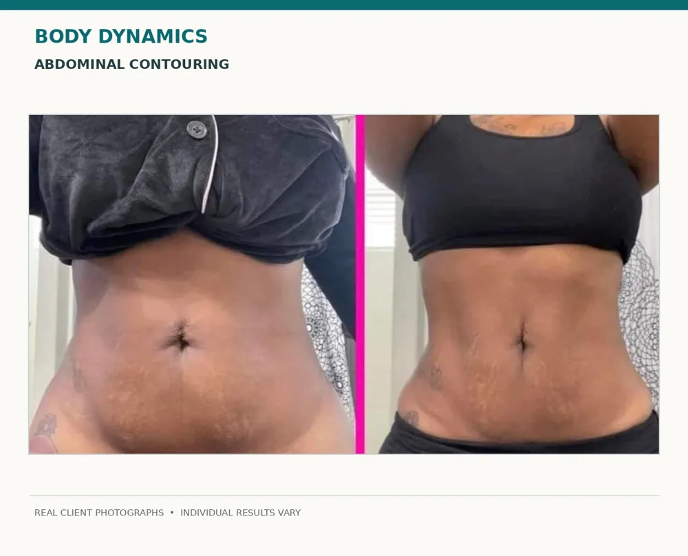 Body Dynamics client before-and-after result 1