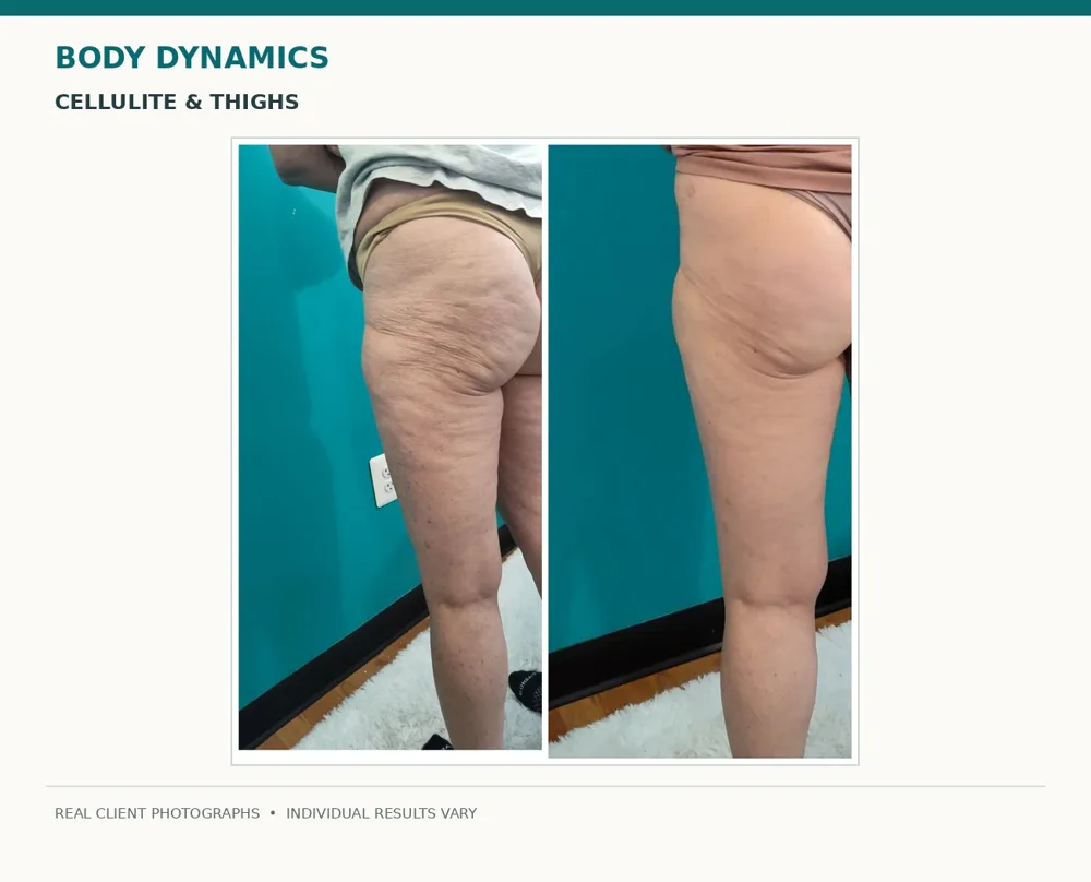Body Dynamics client before-and-after result 2
