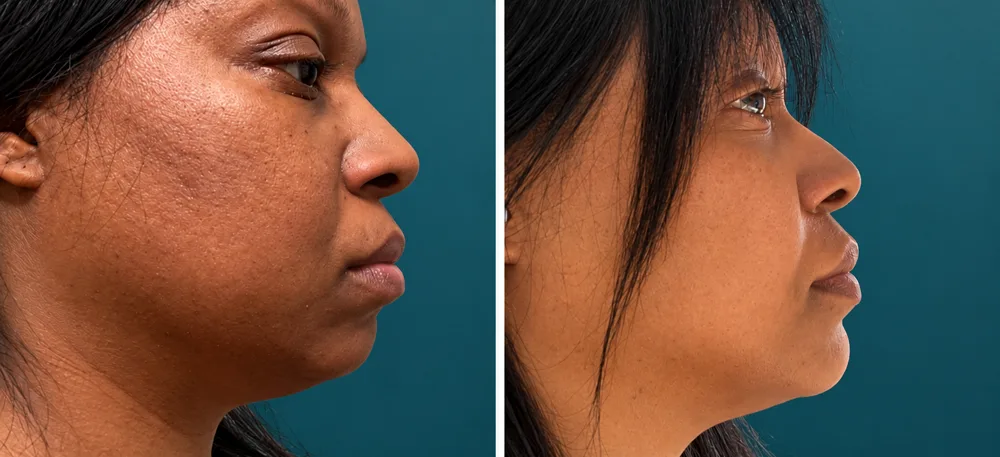 Body Dynamics client before-and-after result 10