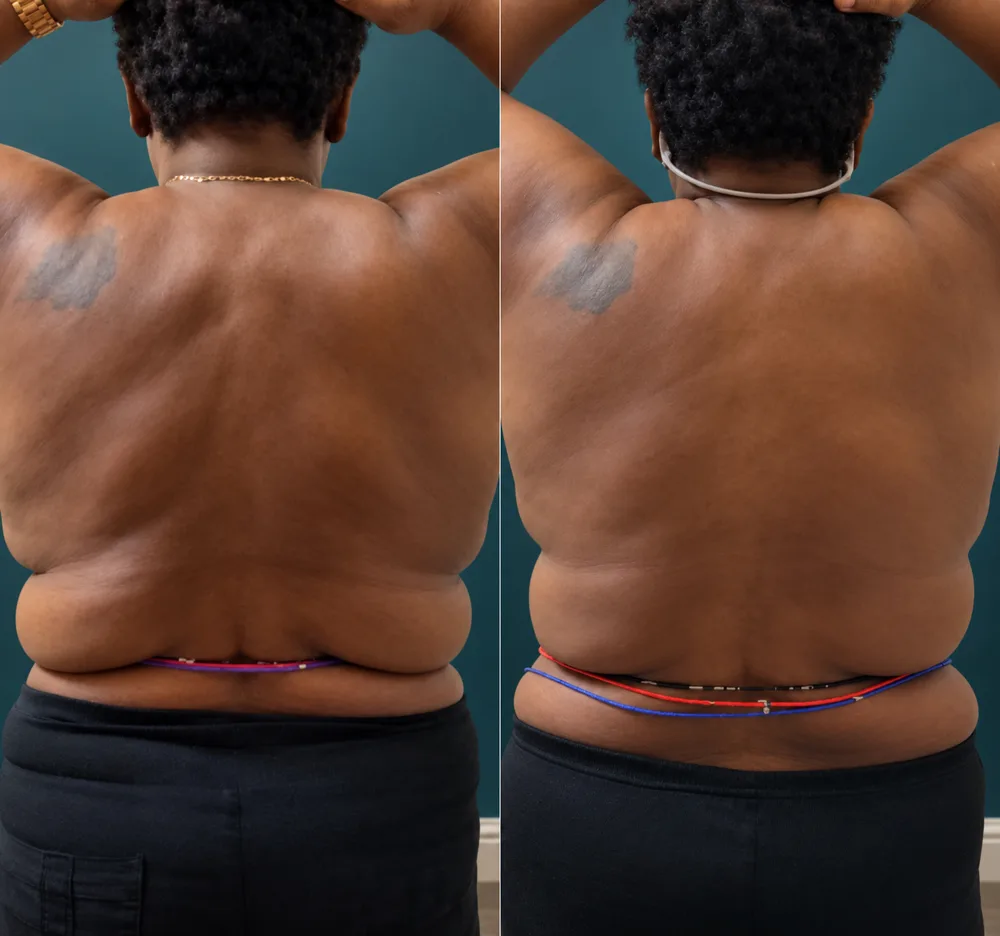 Body Dynamics client before-and-after result 5