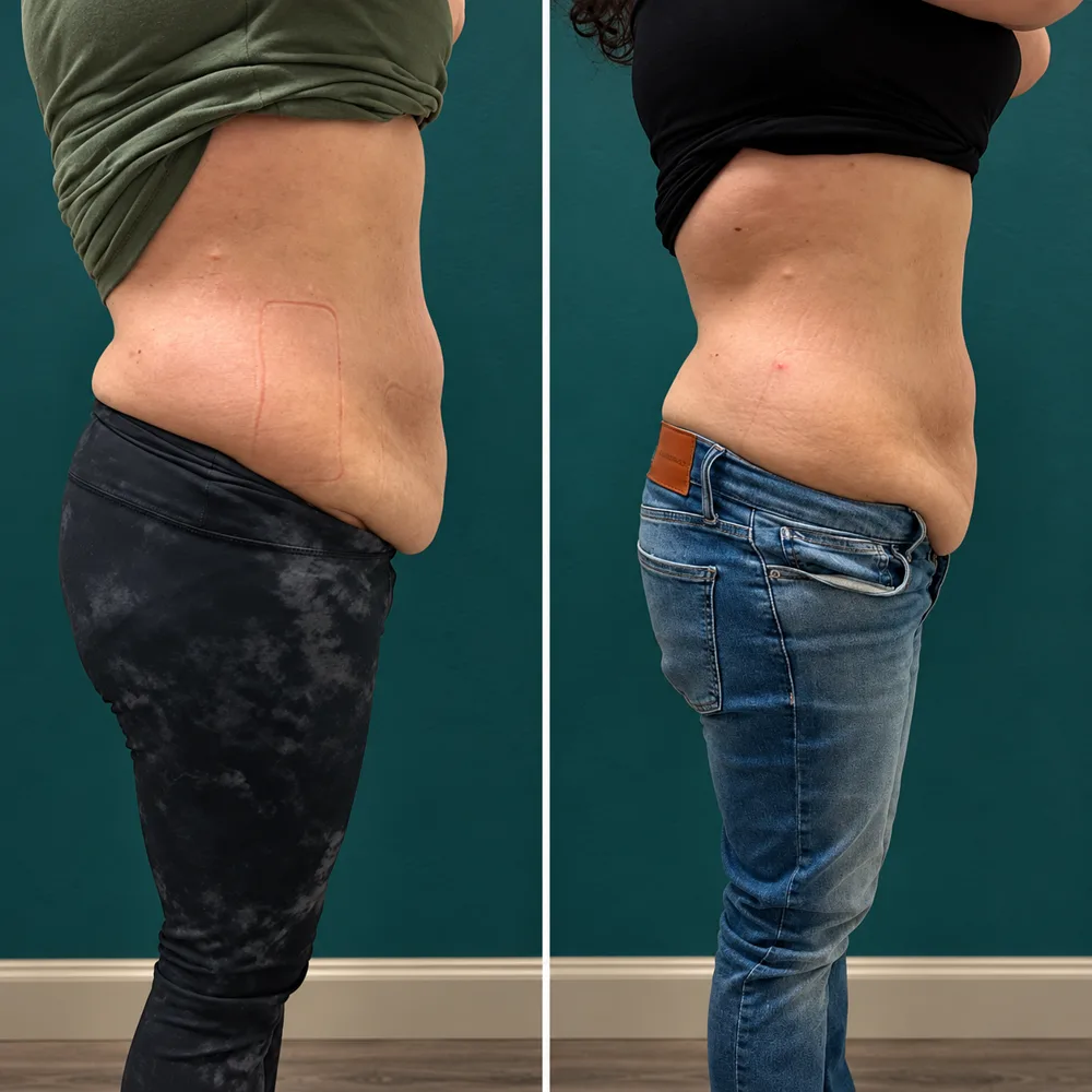 Body Dynamics client before-and-after result 6