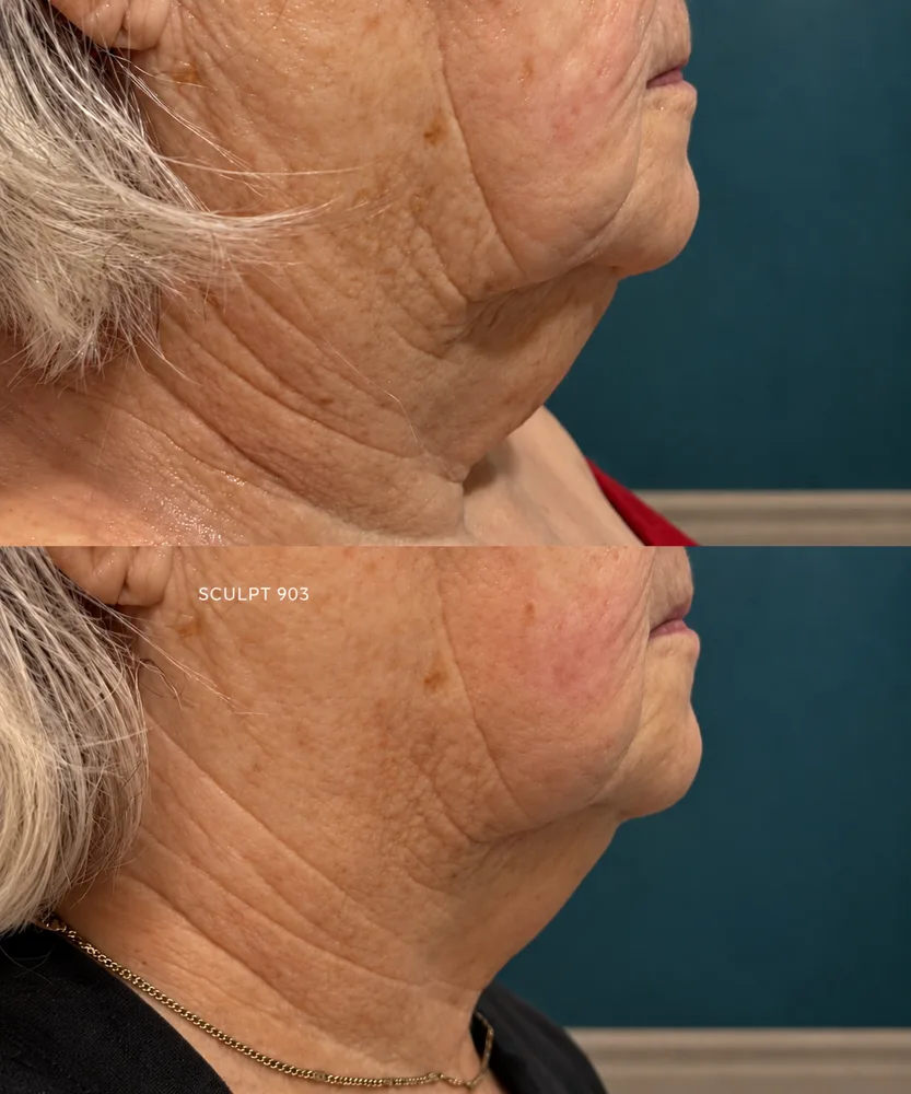 Body Dynamics client before-and-after result 12