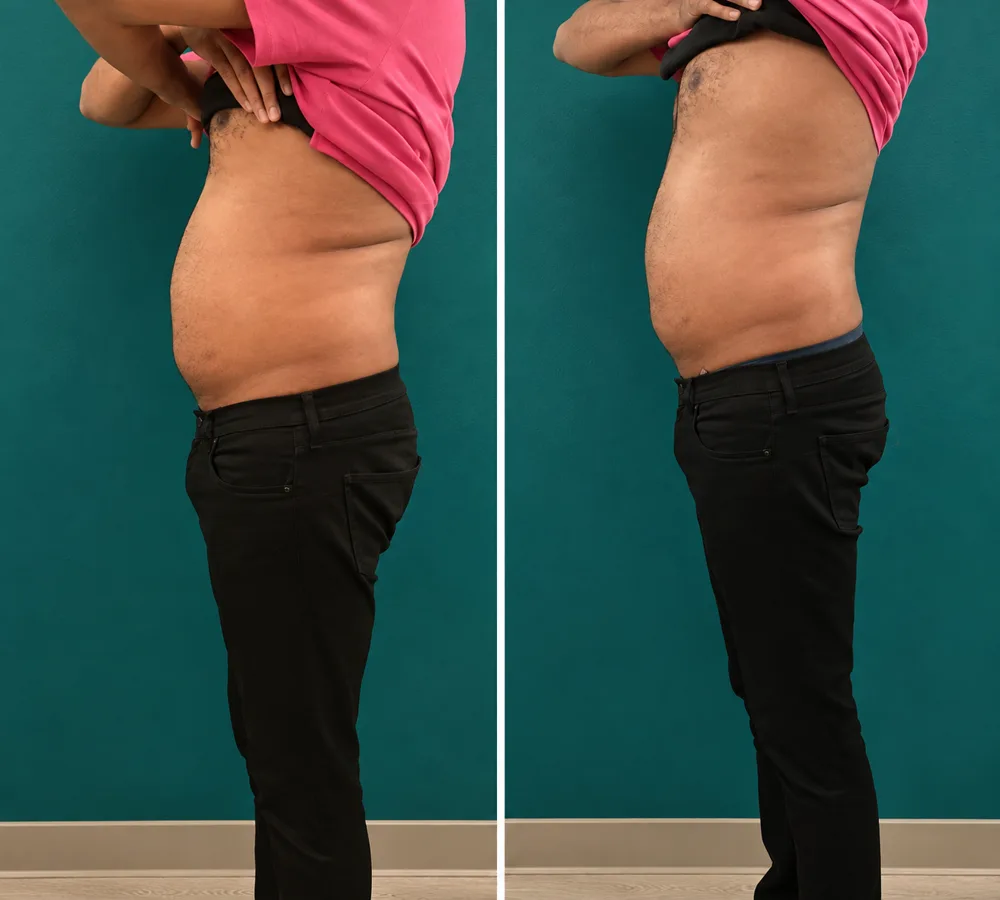 Body Dynamics client before-and-after result 14