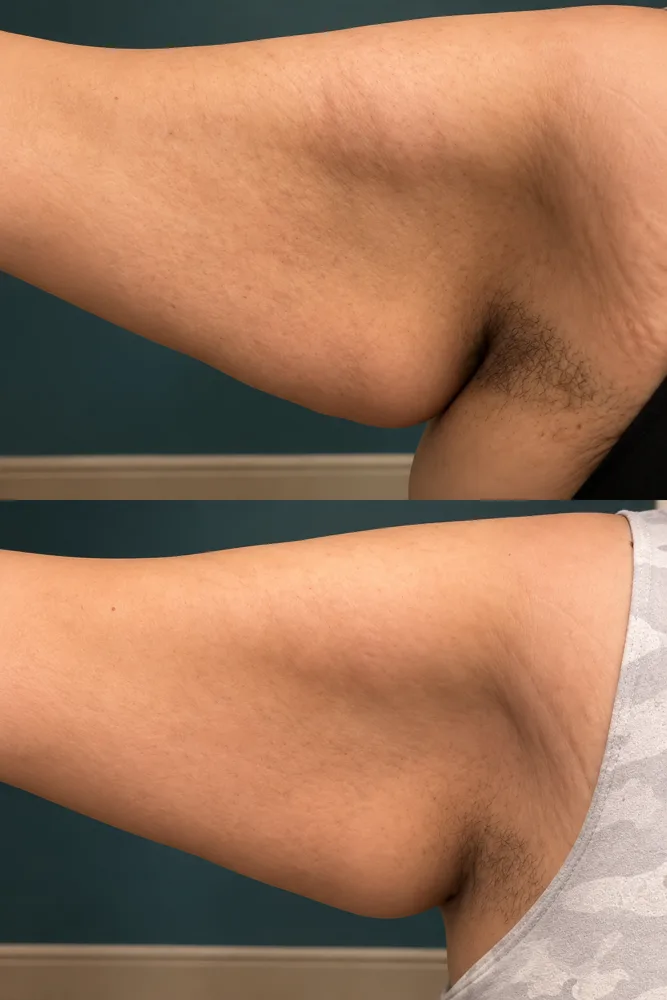 Body Dynamics client before-and-after result 8