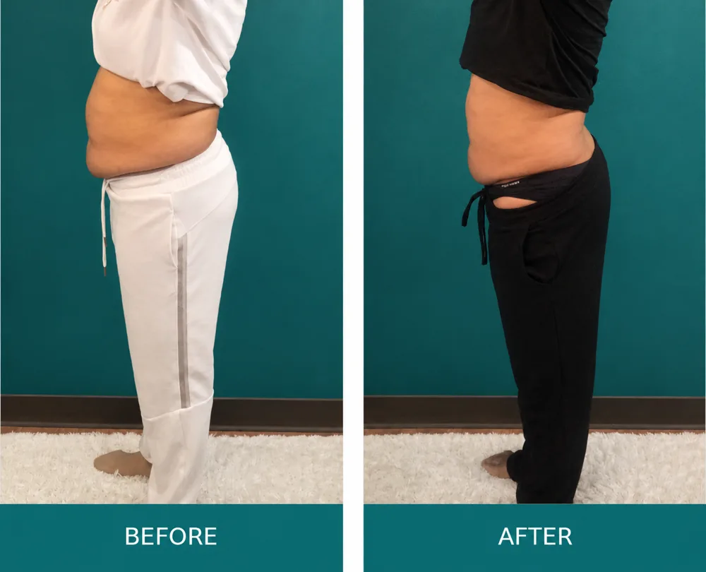 Body Dynamics client before-and-after result 13
