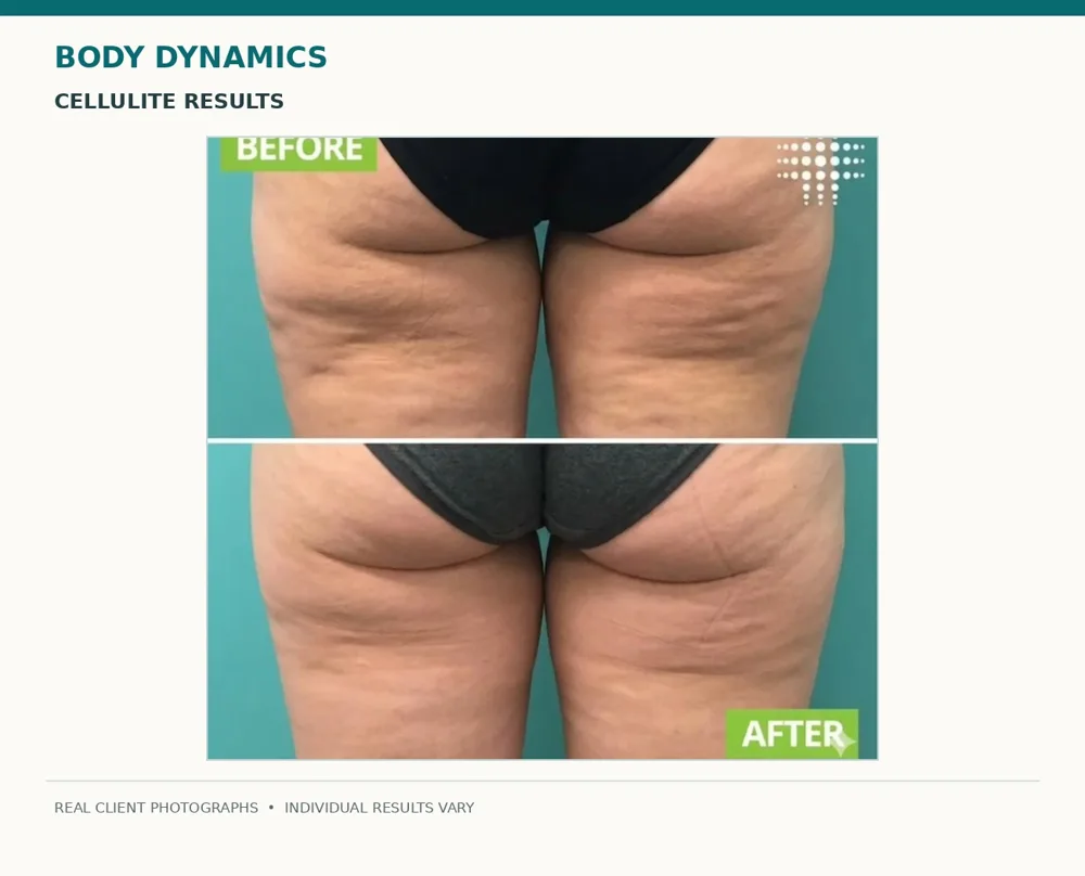 Body Dynamics client before-and-after result 3